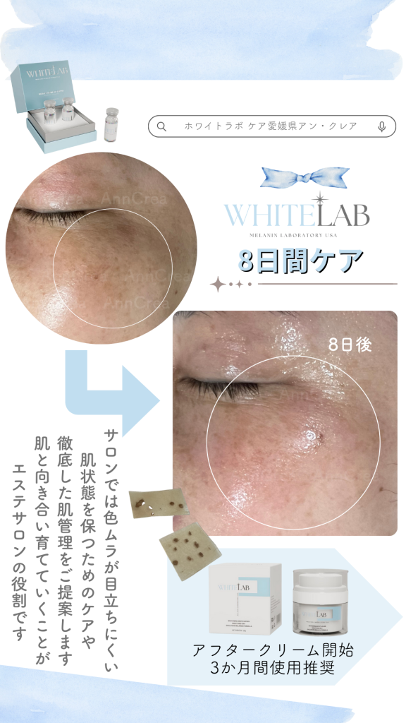 ブライトニングケア／ホワイトラボ（WHITE LAB）症例