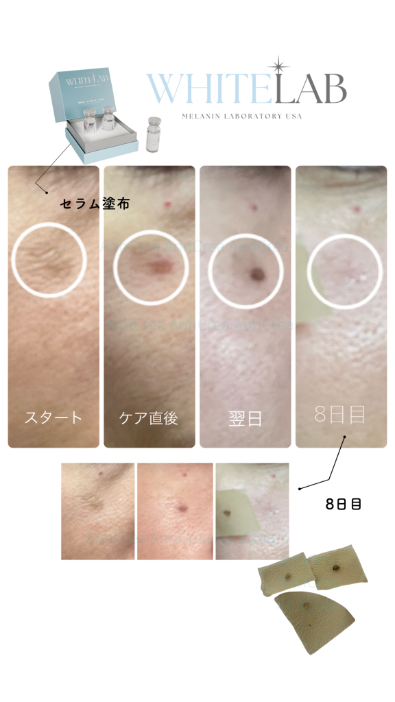 最新シミケア「ホワイトラボ」愛媛県西条市でスタート♪